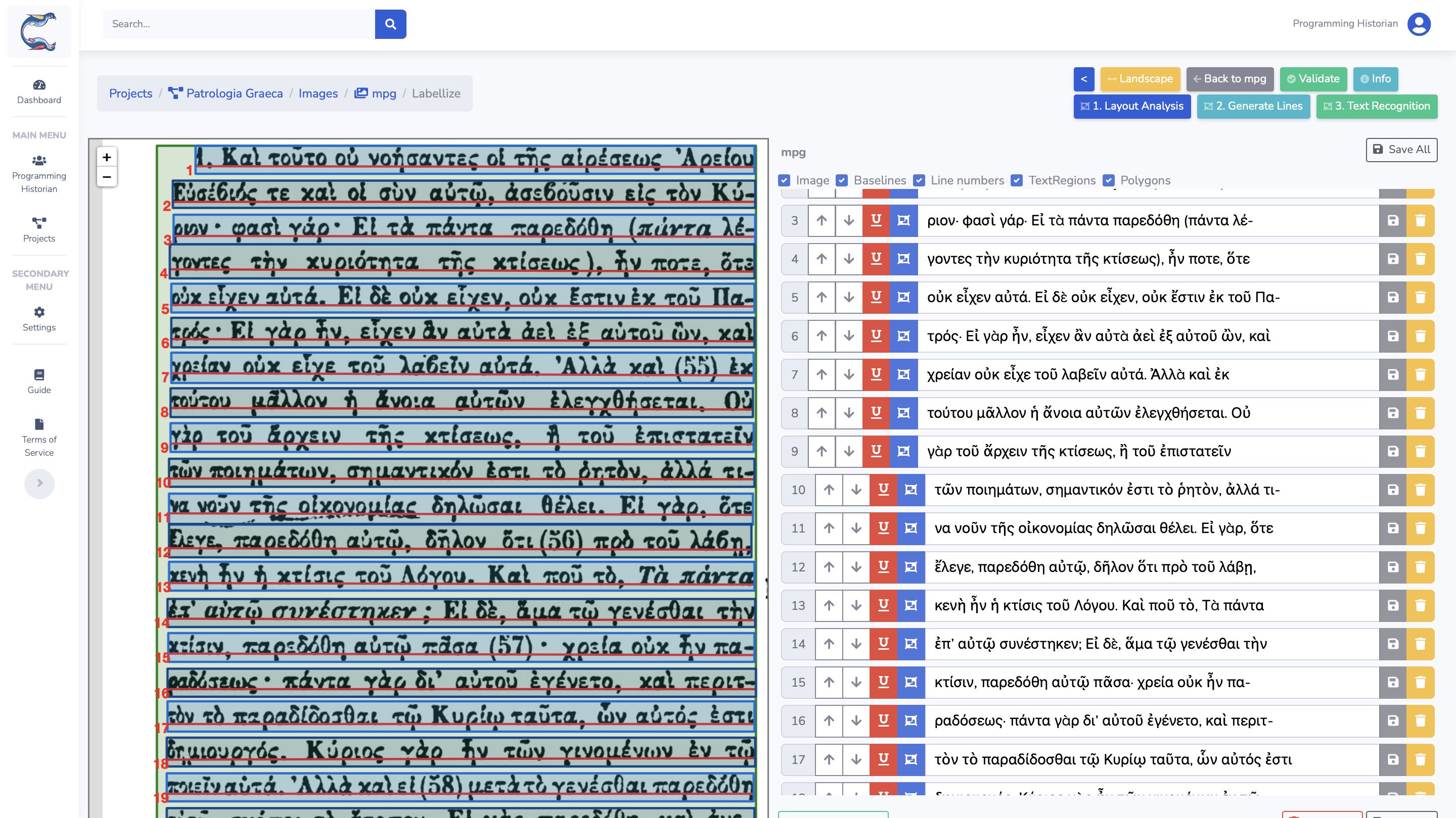 L'interface de transcription sur Calfa Vision